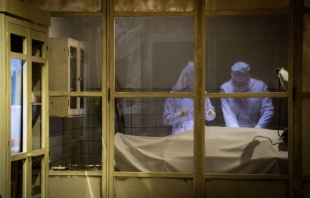 Торчат нитки и дыра в груди: тулячка сделала неудачную маммопластику в частной клинике