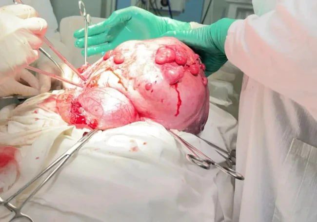 ���������� ������ ��������� �� ��������, ������ 14-������������� �������