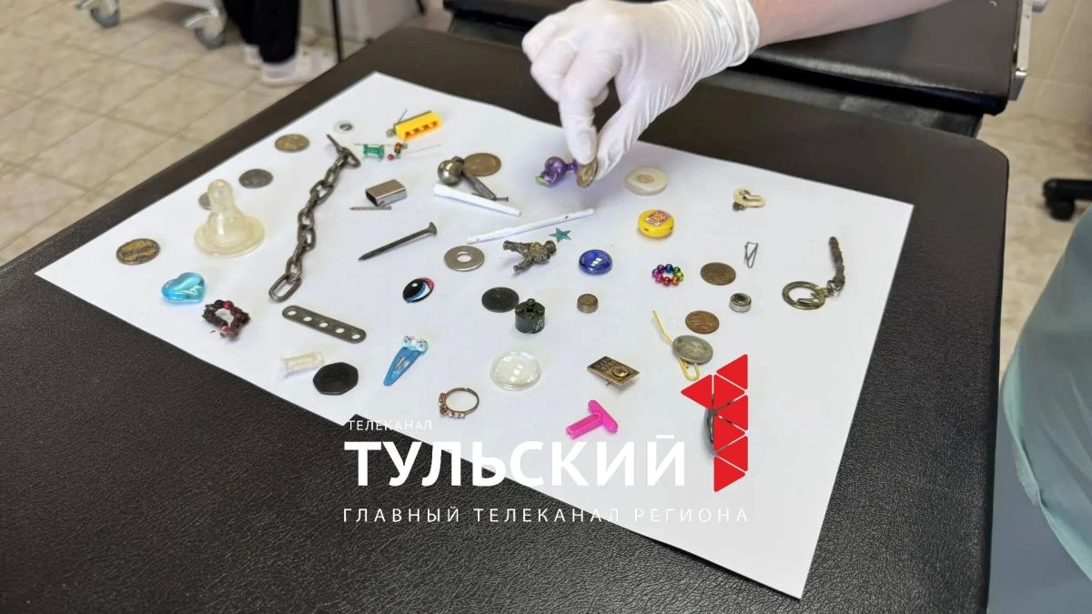 Тульский хирург показала коллекцию проглоченных детьми предметов Тульский хирург показала коллекцию проглоченных детьми предметов