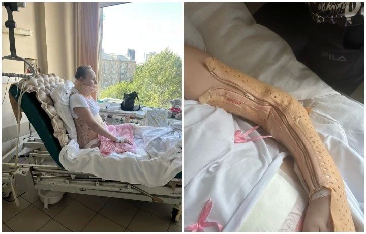 Пострадавшую при атаке БПЛА тулячку ждёт сложная операция на позвоночнике