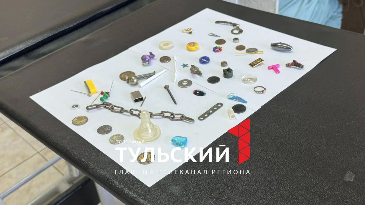 Тульский хирург показала коллекцию проглоченных детьми предметов Тульский хирург показала коллекцию проглоченных детьми предметов