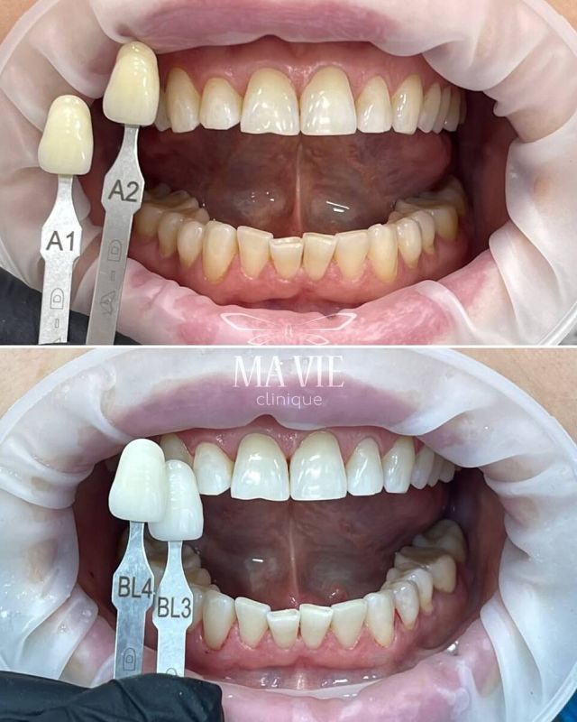 ���� �� �����: ������ ��� �� ������ ������ ��������?