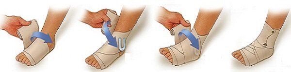 Вывих или растяжение лодыжки: основные рекомендации по помощи